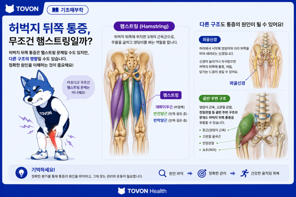 허벅지 뒤쪽 통증이 햄스트링 외 다른 구조와도 관련될 수 있음을 보여주는 이미지